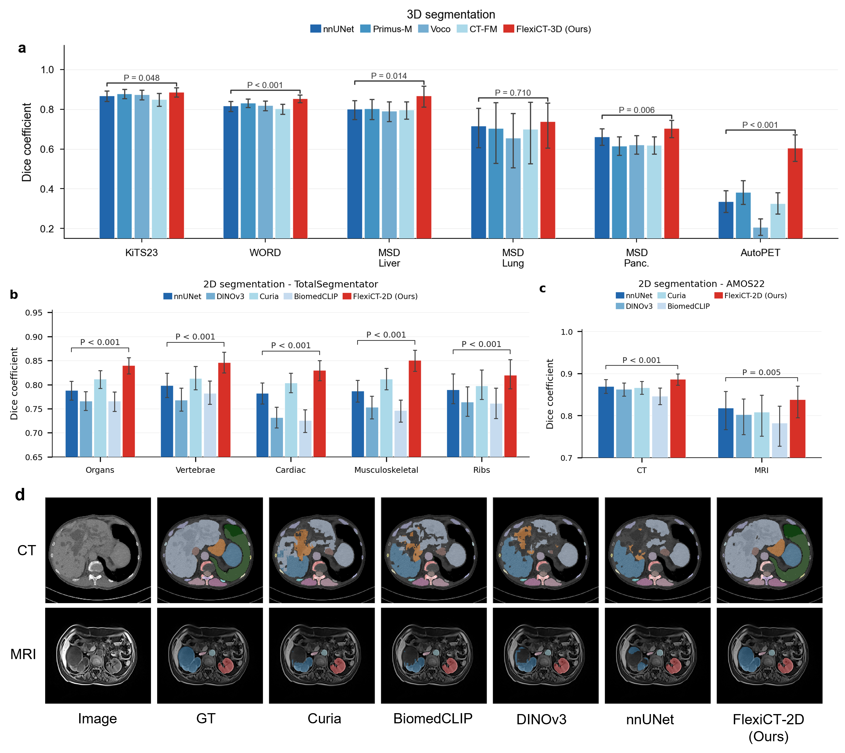 FlexiCT segmentation benchmark results across organ and tumor datasets.